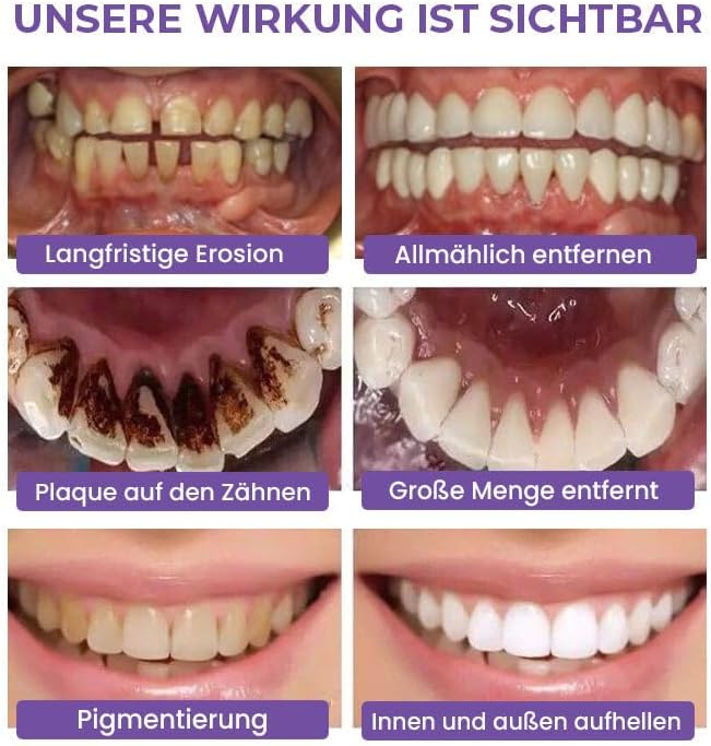 Dental Purple Toothpaste for Teeth Whitening