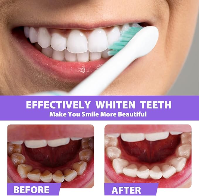 Dental Purple Toothpaste for Teeth Whitening